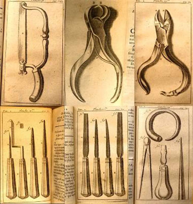 Стоматологічні інструменті з книги П’єра Фошара