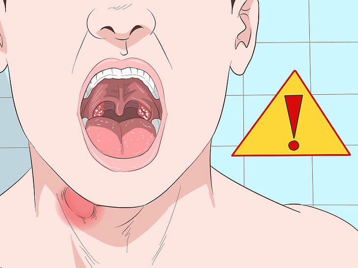 Інфекції горла: чотири перевірених рецепти ліків!